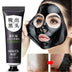 Mask Facial Blackhead